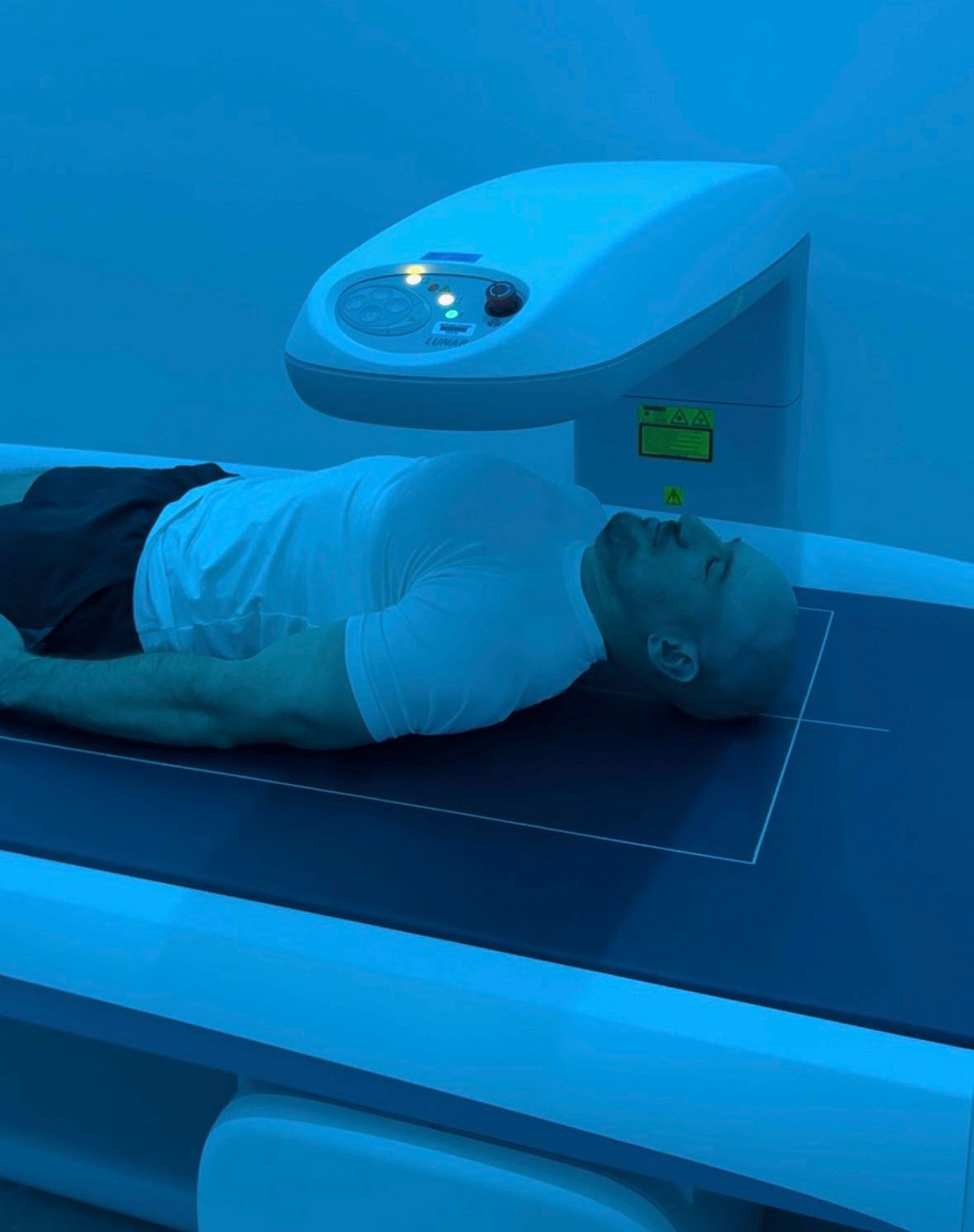 patient on a DEXA scanner
